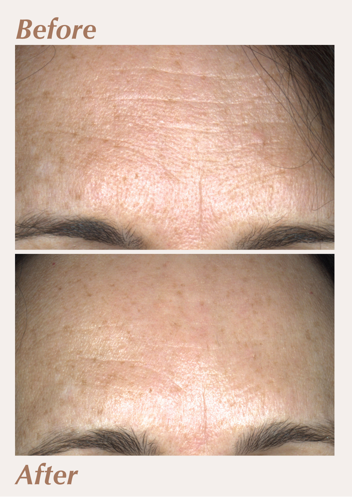 Executive Anti-Ageing Set