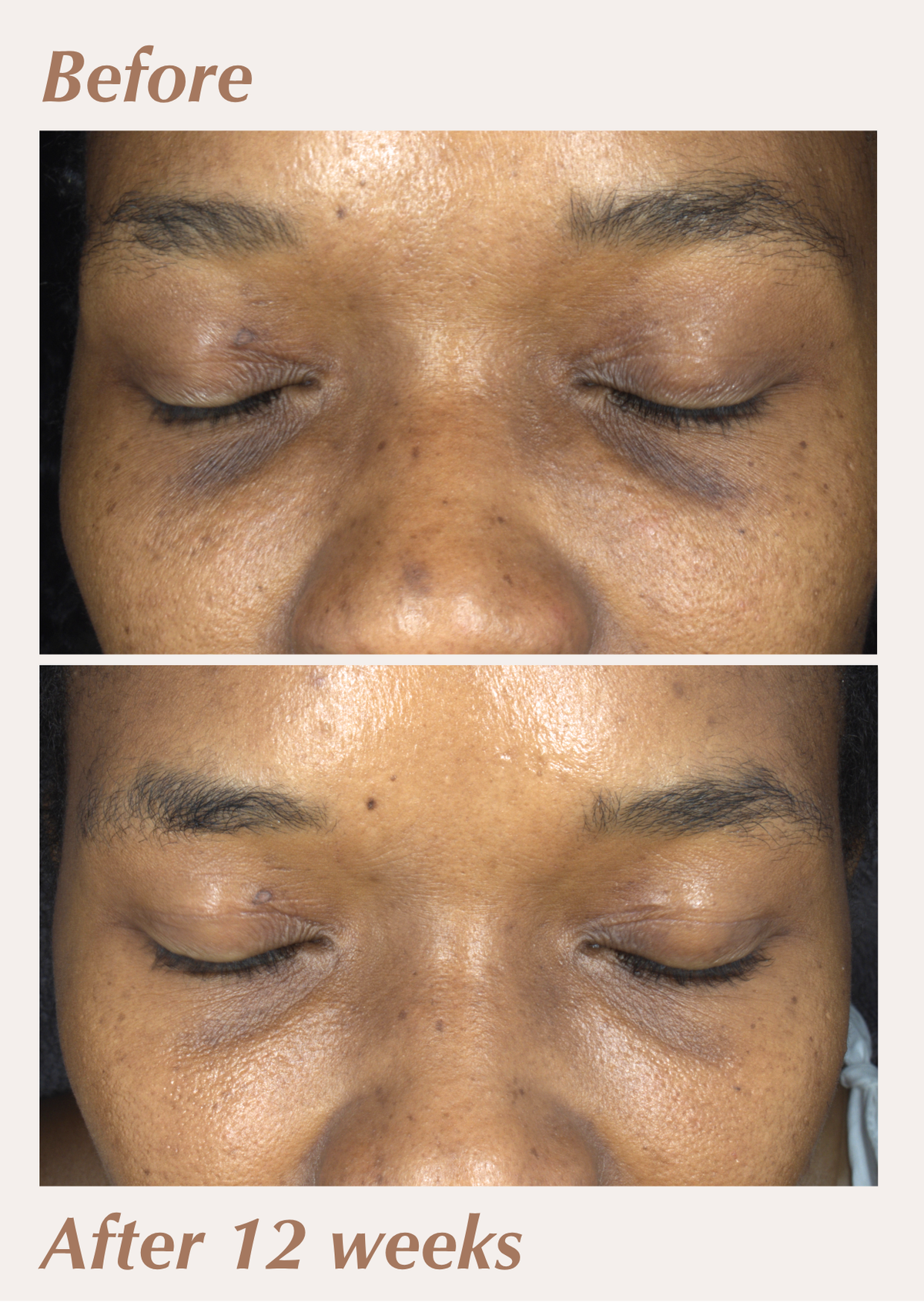 Executive Brightening Set